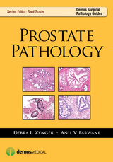 Prostate Pathology - Anil V. Parwani, Debra Zynger