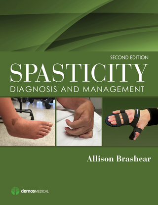 Spasticity, Second Edition