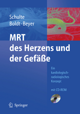 MRT des Herzens und der Gef&auml;&szlig;e - B. Schulte, A. Boldt, D. Beyer