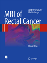 MRI of Rectal Cancer - Arnd-Oliver Sch&auml;fer, Mathias Langer