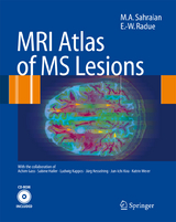 MRI Atlas of MS Lesions - M.A. Sahraian, Ernst-Wilhelm Rad&uuml;