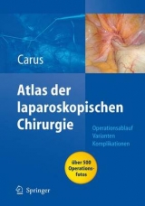 Operationsatlas Laparoskopische Chirurgie - Thomas Carus