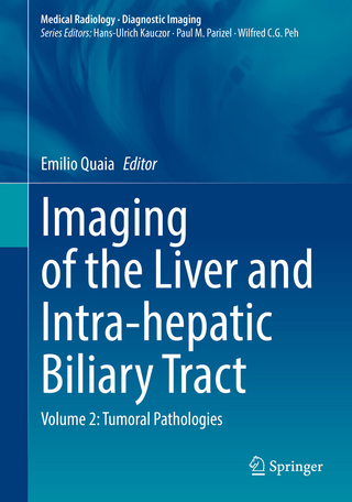Imaging of the Liver and Intra-hepatic Biliary Tract