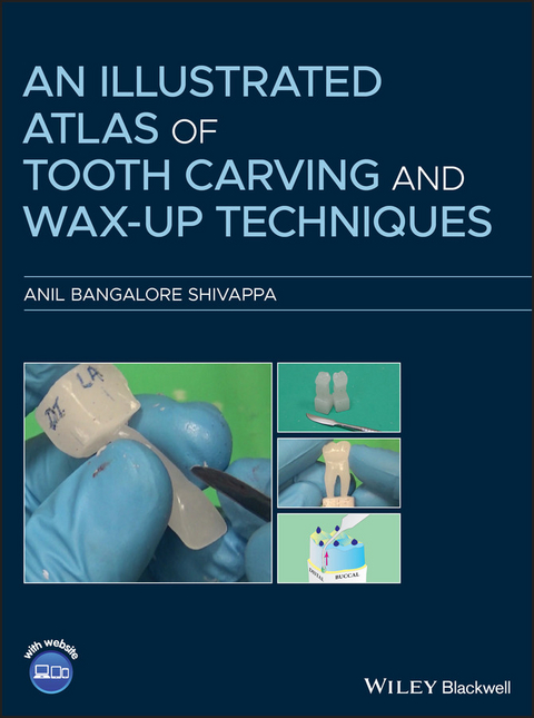 Illustrated Atlas of Tooth Carving and Wax-Up Techniques -  Anil Bangalore Shivappa