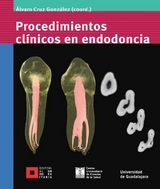 Procedimientos cl&iacute;nicos en endodoncia - &Aacute;lvaro Cruz Gonz&aacute;lez, Ana Rosa Barrag&aacute;n Tejeda, Carlos E. Bracamontes Campoy, Octavio Amezcua Guti&eacute;rrez, Mar&iacute;a Guadalupe S&aacute;nchez Antill&oacute;n, Leobardo Santiago Ruvalcaba Mu&ntilde;oz, Hugo Isaac Contreras Plascencia, Mart&iacute;n Barajas Rodr&iacute;guez, Francisco Y&aacute;&ntilde;ez L&oacute;pez, Mario Uribe Campero, Norberto Broon Ju&aacute;rez, Mart&iacute;n Javier Ch&aacute;vez Brito, Diana Citlalli Garc&iacute;a Ram&iacute;rez, Hilda Patricia Cholico Rodr&iacute;guez, L. Gerardo Gasc&oacute;n Guerra, Celin A. de Le&oacute;n Aguayo, Carlos Guerrero Bobadilla