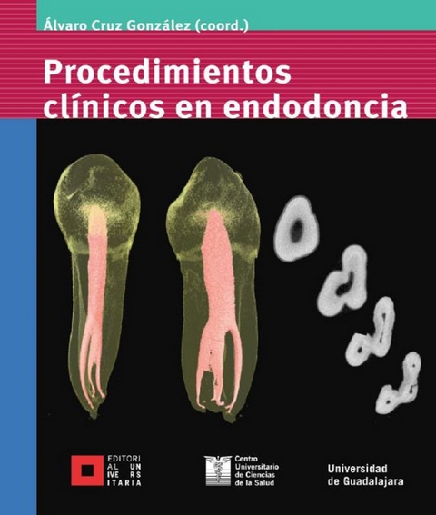 Procedimientos cl&iacute;nicos en endodoncia - &Aacute;lvaro Cruz Gonz&aacute;lez, Ana Rosa Barrag&aacute;n Tejeda, Carlos E. Bracamontes Campoy, Octavio Amezcua Guti&eacute;rrez, Mar&iacute;a Guadalupe S&aacute;nchez Antill&oacute;n, Leobardo Santiago Ruvalcaba Mu&ntilde;oz, Hugo Isaac Contreras Plascencia, Mart&iacute;n Barajas Rodr&iacute;guez, Francisco Y&aacute;&ntilde;ez L&oacute;pez, Mario Uribe Campero, Norberto Broon Ju&aacute;rez, Mart&iacute;n Javier Ch&aacute;vez Brito, Diana Citlalli Garc&iacute;a Ram&iacute;rez, Hilda Patricia Cholico Rodr&iacute;guez, L. Gerardo Gasc&oacute;n Guerra, Celin A. de Le&oacute;n Aguayo, Carlos Guerrero Bobadilla