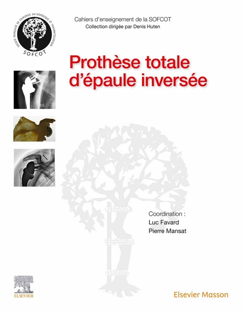 Prothese totale d'epaule inversee -  Luc Favard,  Pierre Mansat,  Sofcot