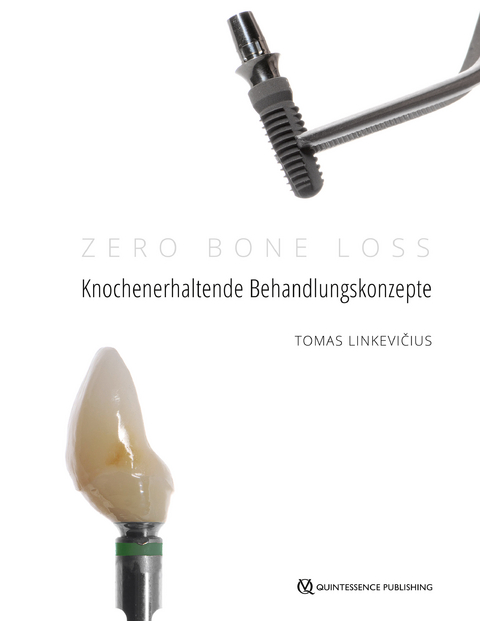 Zero Bone Loss: Knochenerhaltende Behandlungskonzepte - Tomas Linkevičius