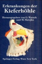 Erkrankungen der Kieferh&ouml;hle - 