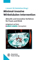 Minimalinvasive Wirbels&auml;ulen-Intervention - 