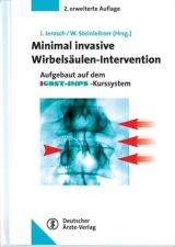 Minimal-Invasive Wirbels&auml;ulen-Intervention - 