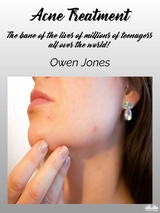 Acne Treatment -  Owen Jones