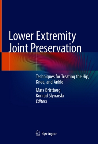 Lower Extremity Joint Preservation