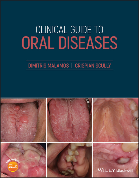 Clinical Guide to Oral Diseases -  Dimitris Malamos,  Crispian Scully