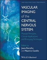 Vascular Imaging of the Central Nervous System - 