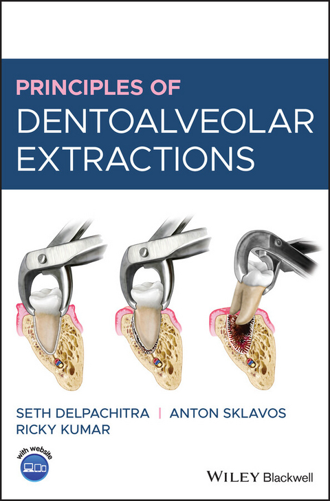 Principles of Dentoalveolar Extractions - Seth Delpachitra, Anton Sklavos, Ricky Kumar