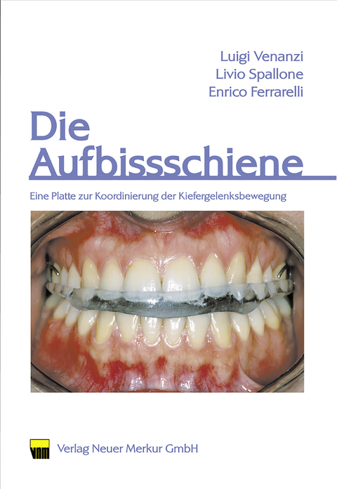 Die Aufbissschiene - Luigi Venanzi, Livio Spallone, Enrico Ferrarelli