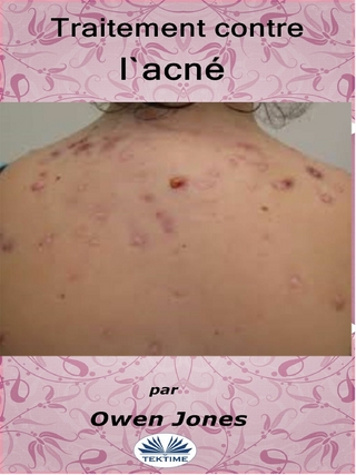Traitement Contre L''Acné