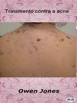 Tratamento Contra A Acne -  Owen Jones