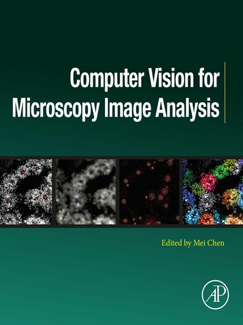 Computer Vision for Microscopy Image Analysis - 