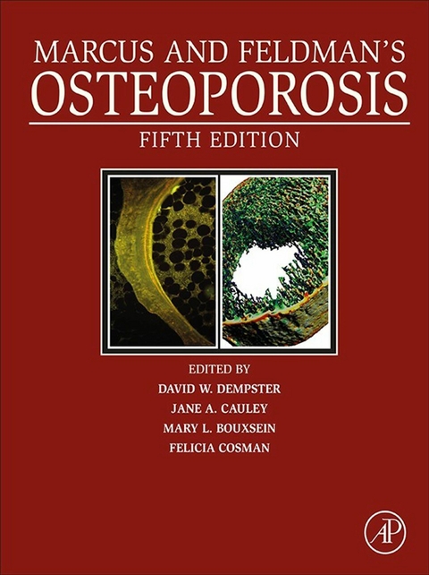 Marcus and Feldman's Osteoporosis - 