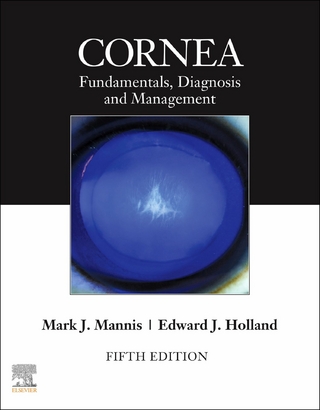 Cornea, E-Book