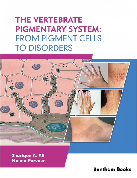 Vertebrate Pigmentary System: From Pigment Cells to Disorders - 