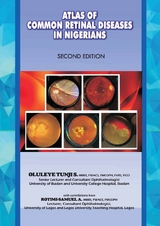 The Atlas of Retinal Diseases in Nigeria - S. Tunji