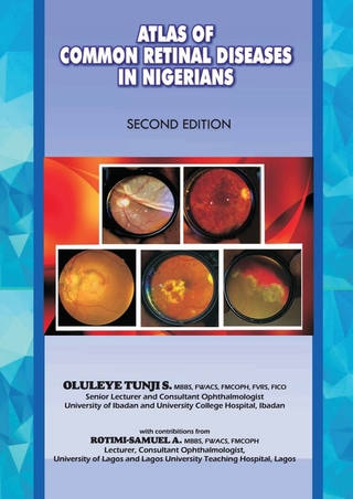 The Atlas of Retinal Diseases in Nigeria