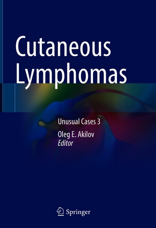 Cutaneous Lymphomas