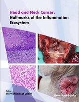 Head and Neck Cancer: Hallmarks of the Inflammation Ecosystem - 