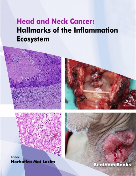 Head and Neck Cancer: Hallmarks of the Inflammation Ecosystem - 