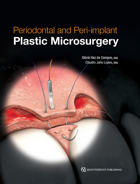 Periodontal and Peri-implant Plastic Microsurgery - Gl&eacute;cio Vaz de Campos, Cl&aacute;udio Julio Lopes