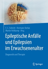 Epileptische Anf&auml;lle und Epilepsien im Erwachsenenalter - 