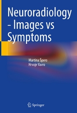 Neuroradiology - Images vs Symptoms - Martina &Scaron;pero, Hrvoje Vavro