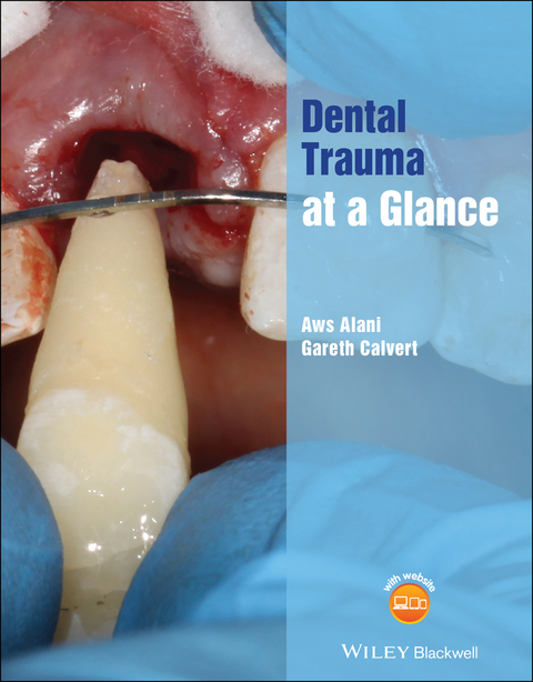 Dental Trauma at a Glance - Aws Alani, Gareth Calvert