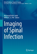 Imaging of Spinal Infection - 