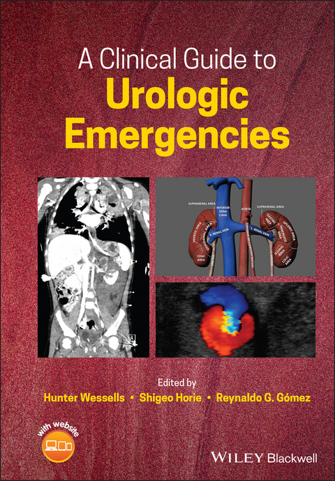 A Clinical Guide to Urologic Emergencies - 