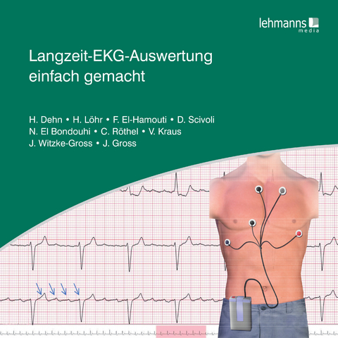 Langzeit-EKG-Auswertung einfach gemacht - Helma Dehn, Heike L&ouml;hr, Faiza El-Hamouti, Daniela Scivoli, Nora El-Bondouhi, Vanessa Kraus, Christina R&ouml;thel, Jutta Witzke-Gross, Joseph Gross