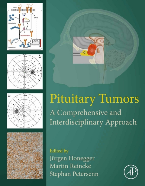 Pituitary Tumors - 