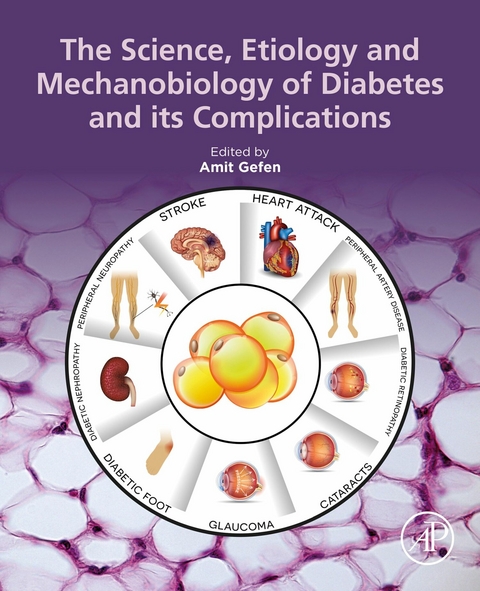 Science, Etiology and Mechanobiology of Diabetes and its Complications - 