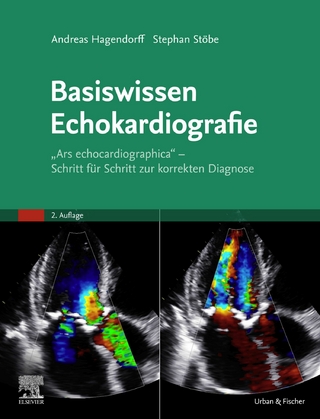 Basiswissen Echokardiografie - Andreas Hagendorff; Stephan Stoebe