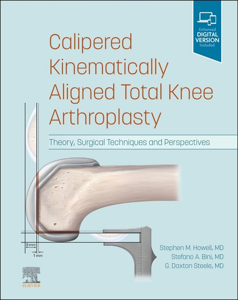 Calipered Kinematically aligned Total Knee Arthroplasty E-Book -  Stefano A. Bini,  Stephen M. Howell,  G. Daxton Steele
