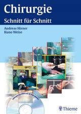 Chirurgie. "Schnitt f&uuml;r Schnitt" - 