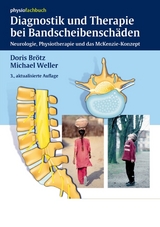 Diagnostik und Therapie bei Bandscheibenschäden - Brötz, Doris; Weller, Michael