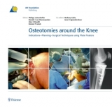 Osteotomies Around the Knee - Philipp Lobenhoffer, Ronald J. van Heerwaarden, Alex E. Staubli, Roland P. Jakob