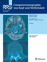 Computertomographie von Kopf und Wirbels&auml;ule - Norbert Hosten, Thomas Liebig