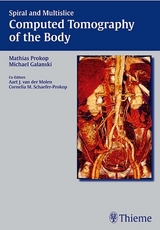 Spiral and Multislice Computed Tomography of the Body - 