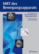 MRT des Bewegungsapparats - 