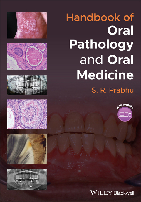 Handbook of Oral Pathology and Oral Medicine -  S. R. Prabhu